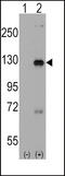 Disheveled-associated activator of morphogenesis 1 antibody, 61-450, ProSci, Western Blot image 