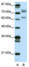 Transcriptional repressor p66-beta antibody, TA331822, Origene, Western Blot image 