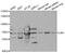 Lamin B Receptor antibody, MBS2523991, MyBioSource, Western Blot image 