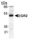 Early Growth Response 2 antibody, NB110-59723, Novus Biologicals, Western Blot image 