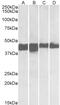 Purine Nucleoside Phosphorylase antibody, 43-273, ProSci, Enzyme Linked Immunosorbent Assay image 