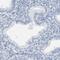 Sperm Acrosome Associated 3 antibody, PA5-54852, Invitrogen Antibodies, Immunohistochemistry frozen image 