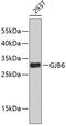 Gap junction beta-6 protein antibody, 18-864, ProSci, Western Blot image 