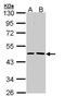 Epoxide Hydrolase 1 antibody, TA308517, Origene, Western Blot image 