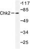 Checkpoint Kinase 2 antibody, LS-C175957, Lifespan Biosciences, Western Blot image 