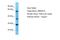 Ankyrin Repeat And Death Domain Containing 1A antibody, A18133, Boster Biological Technology, Western Blot image 