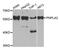 Patatin Like Phospholipase Domain Containing 2 antibody, A6245, ABclonal Technology, Western Blot image 
