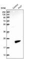 Fragile Histidine Triad Diadenosine Triphosphatase antibody, NBP1-89061, Novus Biologicals, Western Blot image 
