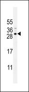 Sperm Acrosome Associated 5B antibody, 55-748, ProSci, Western Blot image 
