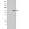 NDC80 Kinetochore Complex Component antibody, orb229456, Biorbyt, Western Blot image 