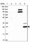 Cytochrome B561 Family Member D2 antibody, NBP1-89415, Novus Biologicals, Western Blot image 
