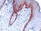 Keratin 5 antibody, PA5-32465, Invitrogen Antibodies, Immunohistochemistry paraffin image 