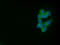 Polymorphic epithelial mucin antibody, SM1708F, Origene, Immunofluorescence image 