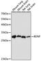 Brain Derived Neurotrophic Factor antibody, 18-303, ProSci, Western Blot image 