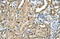 T-Box 15 antibody, ARP47723_T100, Aviva Systems Biology, Immunohistochemistry paraffin image 