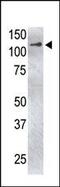 Ubiquitin carboxyl-terminal hydrolase 4 antibody, 61-097, ProSci, Western Blot image 