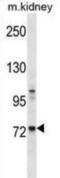 Tyrosine-protein kinase Tec antibody, abx028297, Abbexa, Western Blot image 