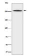 Chromodomain Helicase DNA Binding Protein 3 antibody, M03200, Boster Biological Technology, Western Blot image 