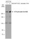 ATR Serine/Threonine Kinase antibody, GTX133852, GeneTex, Western Blot image 