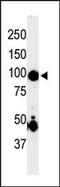 Mitogen-Activated Protein Kinase Kinase Kinase Kinase 2 antibody, 62-630, ProSci, Western Blot image 