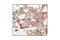 Keratin 6A antibody, 4545S, Cell Signaling Technology, Immunohistochemistry paraffin image 