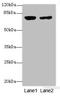 Lanosterol synthase antibody, LS-C676007, Lifespan Biosciences, Western Blot image 