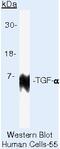 Transforming Growth Factor Alpha antibody, MA5-13907, Invitrogen Antibodies, Western Blot image 