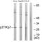 Cyclin Dependent Kinase Inhibitor 1B antibody, LS-C117916, Lifespan Biosciences, Western Blot image 