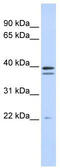 Rab Geranylgeranyltransferase Subunit Beta antibody, TA346725, Origene, Western Blot image 