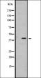 Integrin Subunit Alpha 8 antibody, orb337789, Biorbyt, Western Blot image 