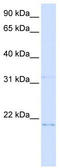 Chromosome 14 Open Reading Frame 180 antibody, TA336147, Origene, Western Blot image 