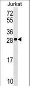 Acidic Nuclear Phosphoprotein 32 Family Member C antibody, LS-C159071, Lifespan Biosciences, Western Blot image 