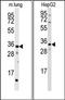 CTD Small Phosphatase 2 antibody, AP15286PU-N, Origene, Western Blot image 