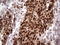 Kruppel Like Factor 9 antibody, M03785, Boster Biological Technology, Immunohistochemistry paraffin image 