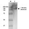 Brevican antibody, MA5-27639, Invitrogen Antibodies, Western Blot image 