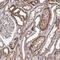 SEC24 Homolog B, COPII Coat Complex Component antibody, NBP1-86263, Novus Biologicals, Immunohistochemistry paraffin image 