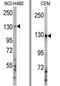 Ubiquitination Factor E4A antibody, AP11965PU-N, Origene, Western Blot image 
