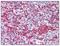 T Cell Immunoglobulin And Mucin Domain Containing 4 antibody, AP07363PU-N, Origene, Immunohistochemistry paraffin image 