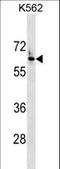 Frizzled Class Receptor 7 antibody, LS-C159692, Lifespan Biosciences, Western Blot image 