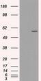 Cytochrome P450 Family 2 Subfamily E Member 1 antibody, GTX84635, GeneTex, Western Blot image 