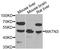 Matrilin 3 antibody, A7700, ABclonal Technology, Western Blot image 