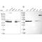 Succinyl-CoA ligase [ADP-forming] subunit beta, mitochondrial antibody, PA5-58787, Invitrogen Antibodies, Western Blot image 