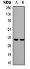 Paired box protein Pax-1 antibody, LS-C358830, Lifespan Biosciences, Western Blot image 