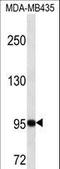 ADF antibody, LS-C166696, Lifespan Biosciences, Western Blot image 