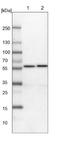 Chaperonin Containing TCP1 Subunit 4 antibody, NBP1-88145, Novus Biologicals, Western Blot image 