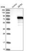 Zinc Finger And BTB Domain Containing 2 antibody, NBP1-88788, Novus Biologicals, Western Blot image 