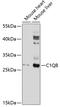 Complement C1q subcomponent subunit B antibody, 13-835, ProSci, Western Blot image 