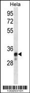 NADH:Ubiquinone Oxidoreductase Core Subunit S8 antibody, 56-500, ProSci, Western Blot image 