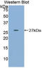 ERBB2 antibody, LS-C293795, Lifespan Biosciences, Western Blot image 