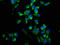 Ubiquitin-conjugating enzyme E2 K antibody, LS-C285693, Lifespan Biosciences, Immunofluorescence image 
